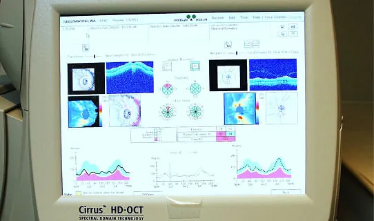 เครื่อง OCT
