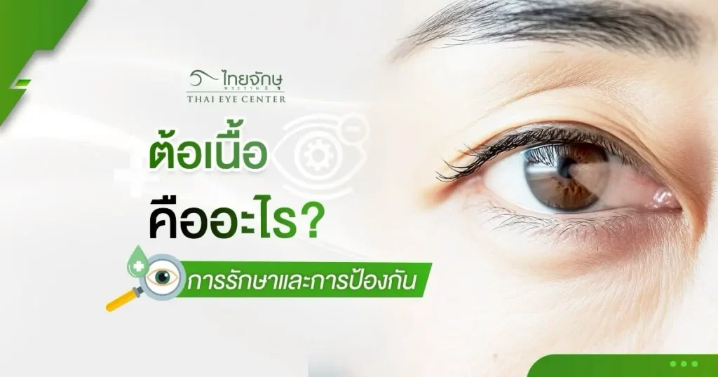 ต้อเนื้ออันตรายไหม